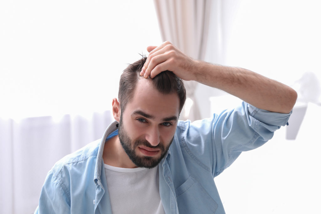 Man with receding hairline