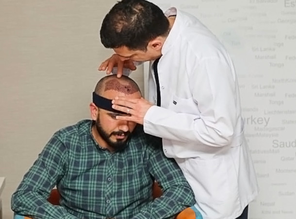 Doctor examining patients head following hair transplant