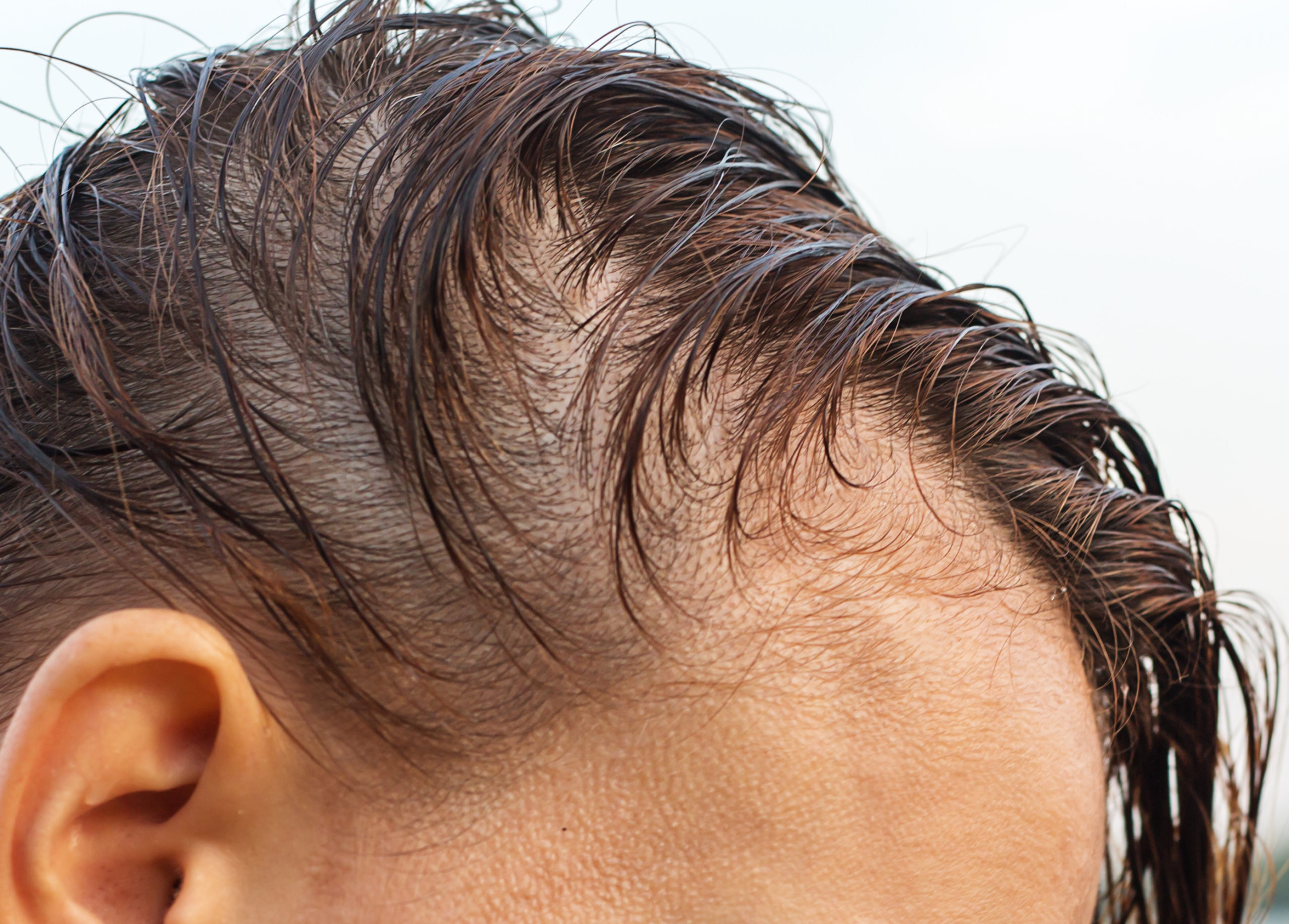 A woman with wet hair showing how her hair thinning
