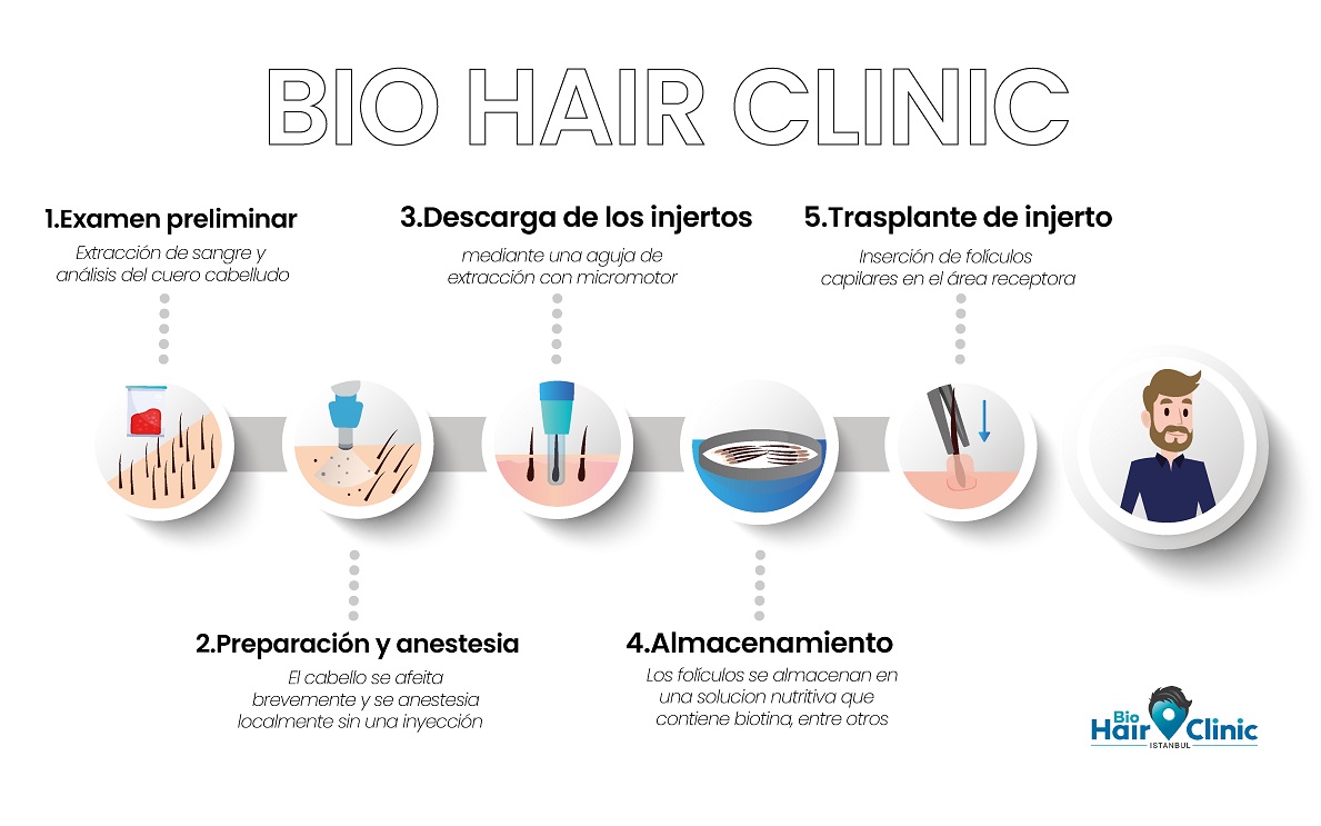 Paso a paso del Trasplante Capilar Bio FUE Procedimiento Transplante Capilar FUE