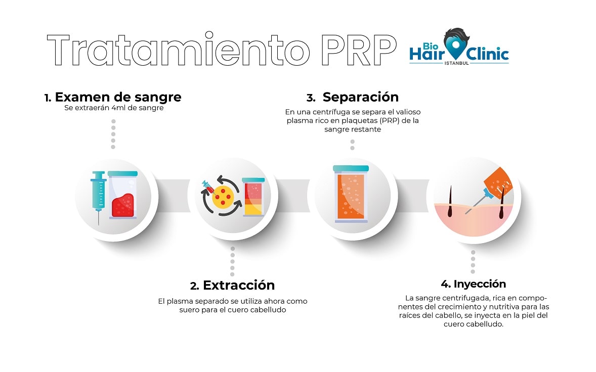 Infografía sobre el procedimiento del tratamiento PRP Procedimiento del tratamiento PRP