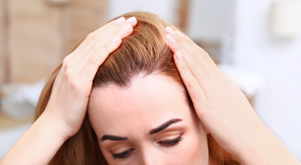 Mujer observando caída de cabello Injerto capilar para mujeres con caída de cabello