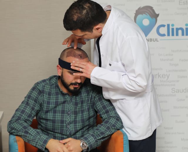 post trapianto capelli con un paziente