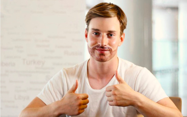 foto di un paziente soddisfatto dopo un trapianto di barba