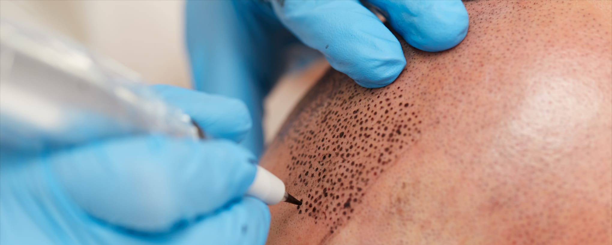 Haarpigmentierung Haarpigmentierung