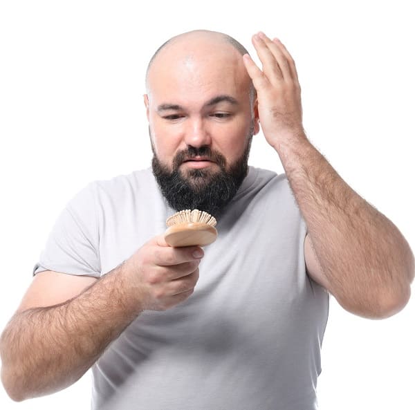 Beweggründe für eine Haarverpflanzung - Alternative zur Glatze bei Haarausfall Beweggründe für eine Haarverpflanzung - Alternative zur Glatze bei Haarausfall