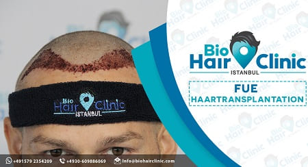 FUE Hohlnadel Haartransplantation Bio Hair Clinic