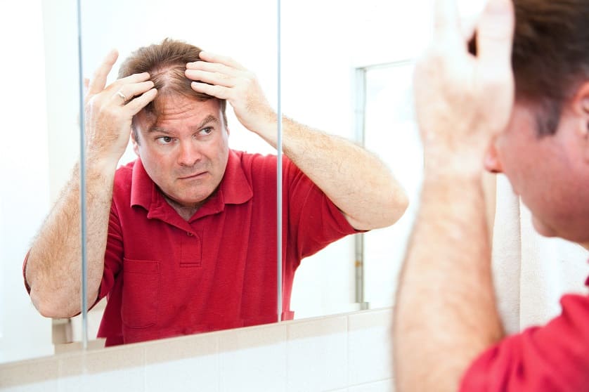 Haarausfall Ursachen bei Männer