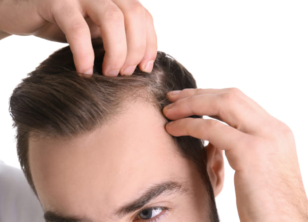 Misslungene Haartransplantation Mann tastet mit Fingern seine Geheimratsecken ab