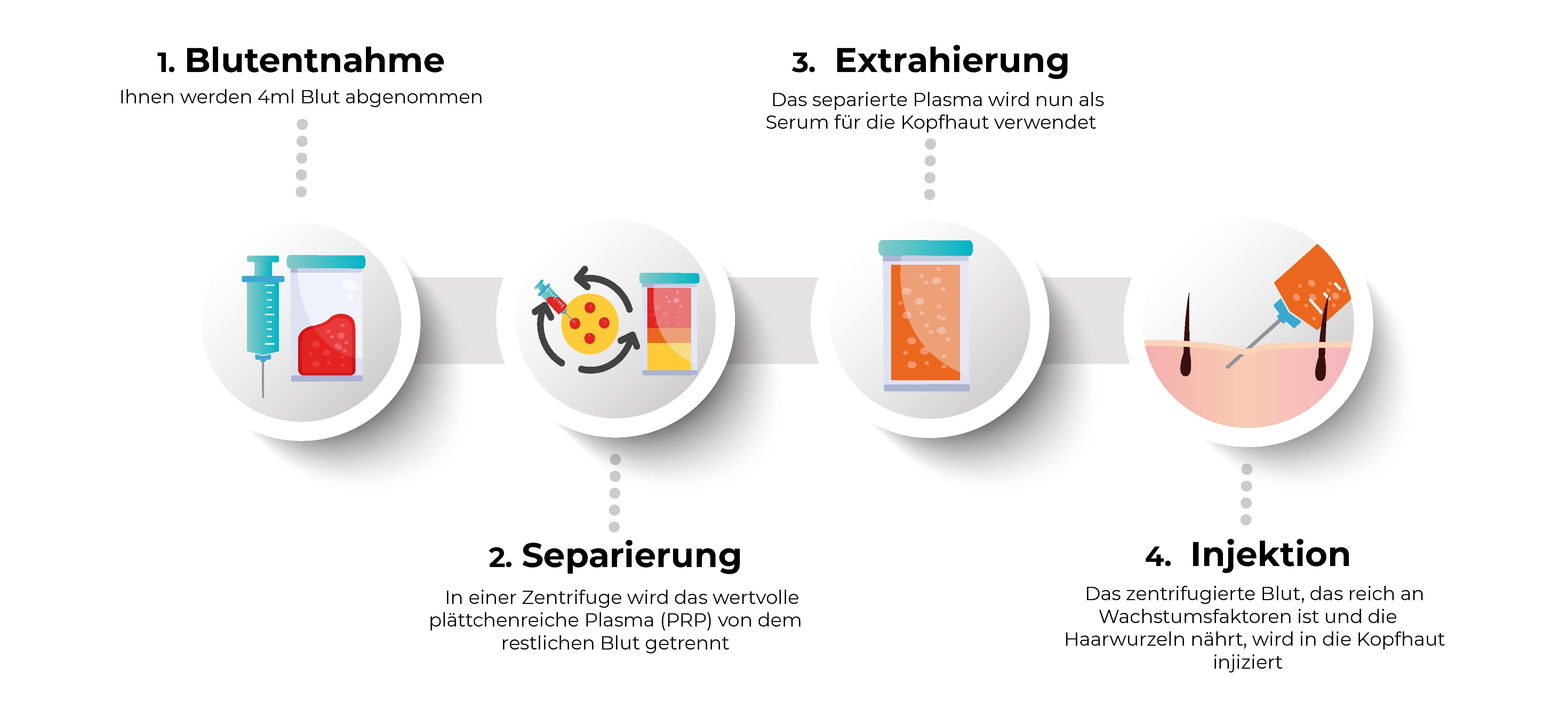 prp technik - plättchenreiches Plasma Behandlung