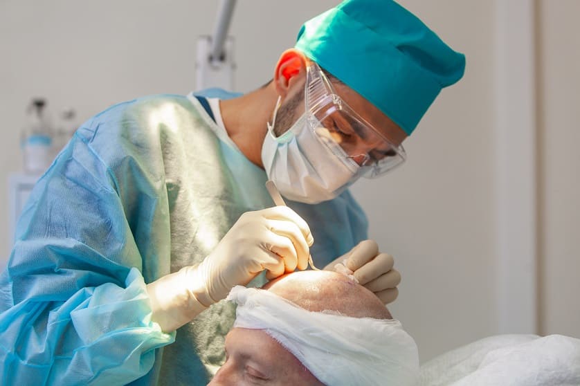 Arzt nimmt bei Patienten eine Haartransplantation vor