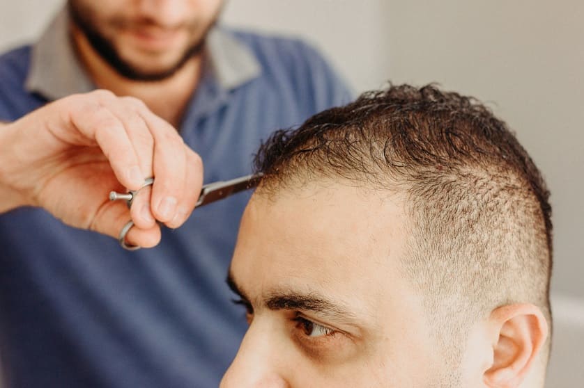 Nach Einer Haartransplantation Konnen Sie Wieder Langere Haare Tragen