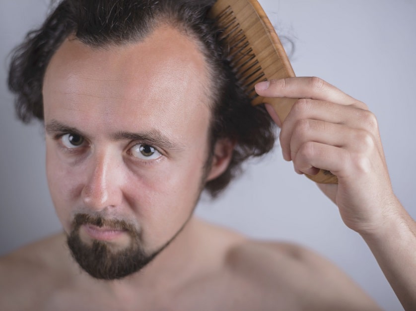 Mann mit Haarausfall kämmt sich die Haare