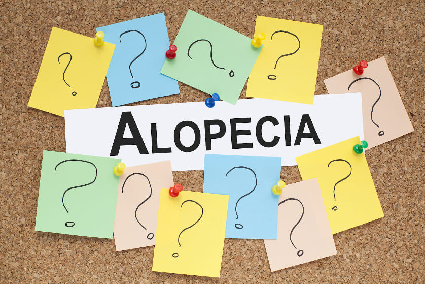 Alopecia universalis: Kompletter Haarverlust am ganzen Körper