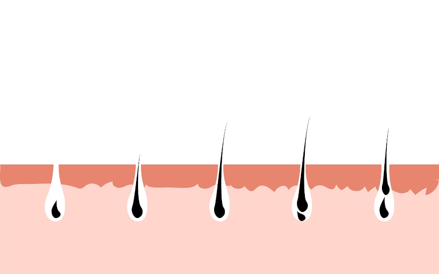 Grafische Illustration des Haarwachstums in fünf Schritten