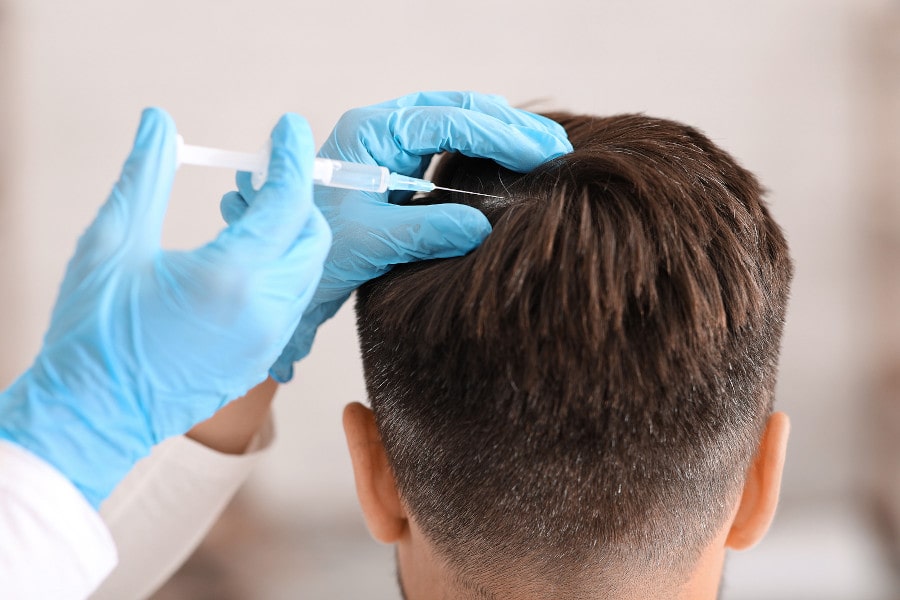 Mann erhält PRP-Behandlung weil die Haartransplantation Voraussetzungen nicht erfüllt sind