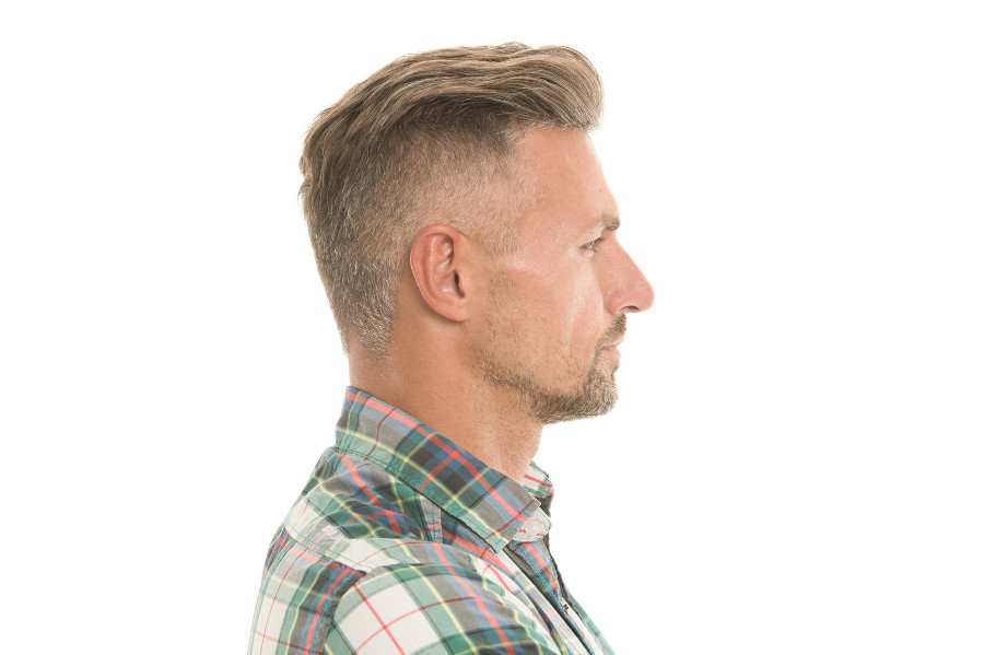 Mann hinterkopf frisur Haarausfall Hinterkopf