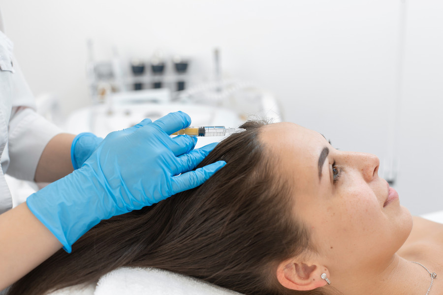Junge Frau behandelt Haarausfall mit Eigenbluttherapie