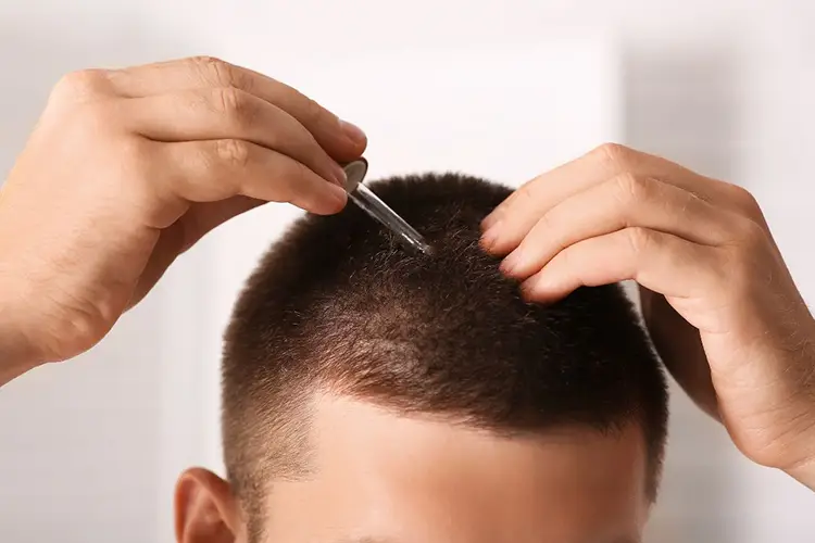 Ein Mann behandelt seine Haare an der Kopfhaut mit einem Serum aus einer Pipette.