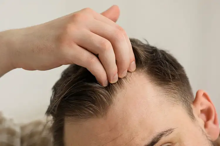 Ein Mann mit Geheimratsecken fasst sich mit einer Hand durch die Haare an der Stirn.
