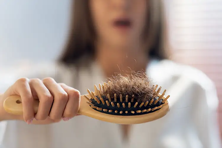 Eine Frau hält eine Bürste in der Hand auf der ein Büschel ausgefallener Haare zu sehen ist.